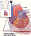 Coronary Calcium. From the National Heart Lung and Blood Institute,
              National Institutes of Health. 