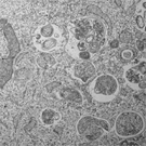 Autophagosomes in starved fibroblasts. Photo: Chieko Kishi & Noboru Mizushima.