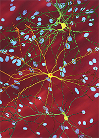 This figure illustrates a striatal neuron (yellow) that harbors the mutant huntingtin protein, which has formed an inclusion body (red). In the paper being featured by ScienceWatch.com, we show that inclusion body formation is a coping response rather than a pathogenic one, as it has been assumed.