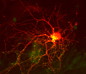 Neuron in mCherry, with GFP-LC3 showing autophagosomes