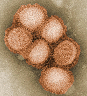 This colorized negative stained transmission electron micrograph (TEM) depicted some of the ultrastructural morphology of the A/CA/4/09 swine flu virus.
