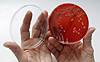 An employee displays MRSA (Methicillin-resistant Staphylococcus aureus) bacteria strain inside a petri dish containing agar jelly for bacterial culture in a microbiological laboratory. MRSA is a drug-resistant "superbug", which can cause deadly infections. REUTERS/Fabrizio Bensch.