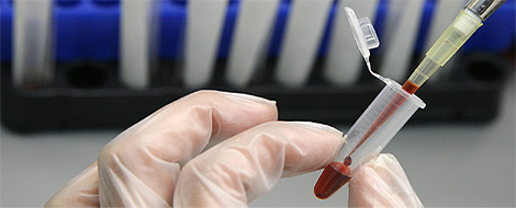 A laboratory technician examines blood samples for HIV/AIDS in a 
        public hospital in Valparaiso city, November 14, 2008. REUTERS/Eliseo 
        Fernandez
